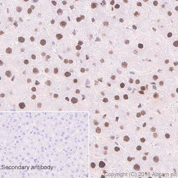 Immunohistochemistry (Formalin/PFA-fixed paraffin-embedded sections) - Anti-RPA32/RPA2 antibody [EPR2877Y] - BSA and Azide free (AB236044)