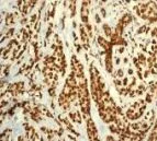 Immunohistochemistry (Formalin/PFA-fixed paraffin-embedded sections) - Anti-RPA32/RPA2 antibody [EPR2877Y] - BSA and Azide free (AB236044)