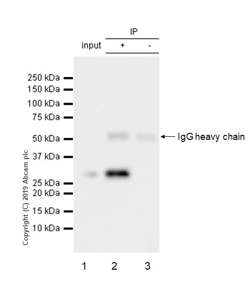 Immunoprecipitation - Anti-RPA32/RPA2 antibody [EPR2877Y] - BSA and Azide free (AB236044)