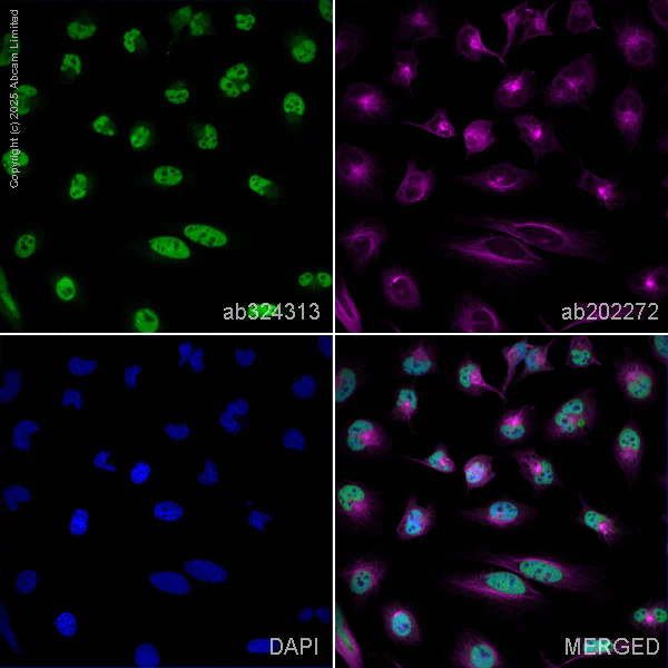 Immunocytochemistry/ Immunofluorescence - Anti-RPA32/RPA2 antibody [EPR2877Y] - Mouse IgG1 (Chimeric) (AB324313)