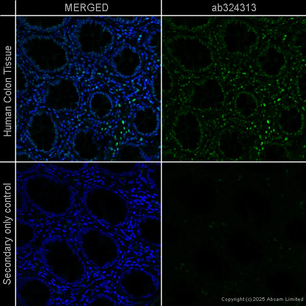 Immunohistochemistry (Formalin/PFA-fixed paraffin-embedded sections) - Anti-RPA32/RPA2 antibody [EPR2877Y] - Mouse IgG1 (Chimeric) (AB324313)