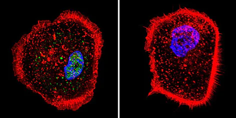 Immunocytochemistry/ Immunofluorescence - Anti-RPA32/RPA2 antibody [MA34] (AB111161)