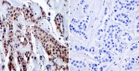 Immunohistochemistry (Formalin/PFA-fixed paraffin-embedded sections) - Anti-RPA32/RPA2 antibody [MA34] (AB111161)