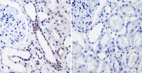 Immunohistochemistry (Formalin/PFA-fixed paraffin-embedded sections) - Anti-RPA32/RPA2 antibody [MA34] (AB111161)