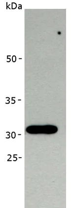 Western blot - Anti-RPA32/RPA2 antibody [MA34] (AB111161)
