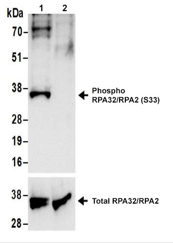 Western blot - Anti-RPA32/RPA2 (phospho S33) antibody (AB211877), expandable thumbnail
