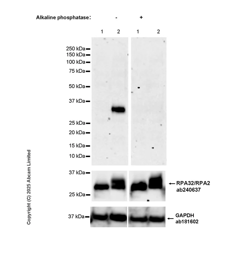 Western blot - Anti-RPA32/RPA2 (phospho S33) antibody [EPR29612-551] (AB325750)