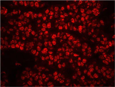Immunohistochemistry (Formalin/PFA-fixed paraffin-embedded sections) - Anti-RPA32/RPA2 (phospho S4 + S8) antibody (AB87277)