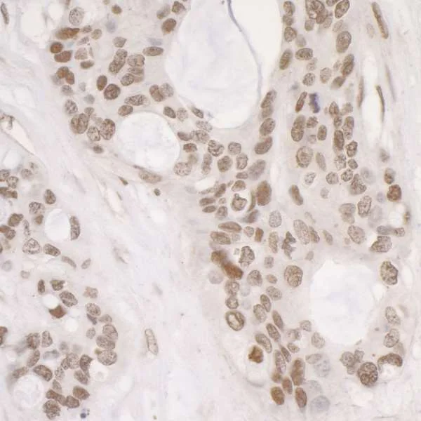 Immunohistochemistry (Formalin/PFA-fixed paraffin-embedded sections) - Anti-RPA32/RPA2 (phospho S4 + S8) antibody (AB87277)