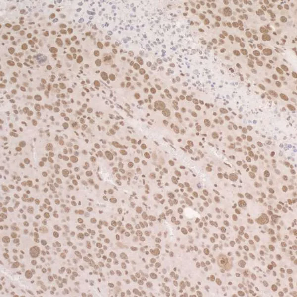 Immunohistochemistry (Formalin/PFA-fixed paraffin-embedded sections) - Anti-RPA32/RPA2 (phospho S4 + S8) antibody (AB87277)