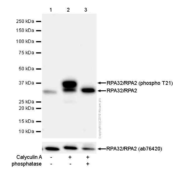 Western blot - Anti-RPA32/RPA2 (phospho T21) antibody [EPR2846(2)] (AB109394)