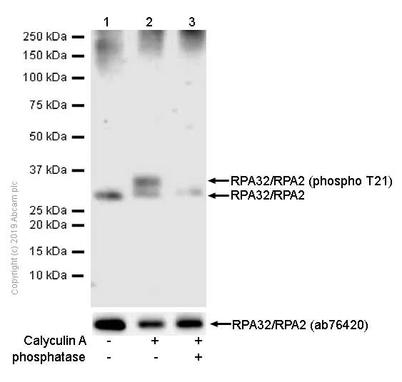 Western blot - Anti-RPA32/RPA2 (phospho T21) antibody [EPR2846(2)] (AB109394)
