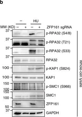 Western blot - Anti-RPA32/RPA2 (phospho T21) antibody [EPR2846(2)] (AB109394)