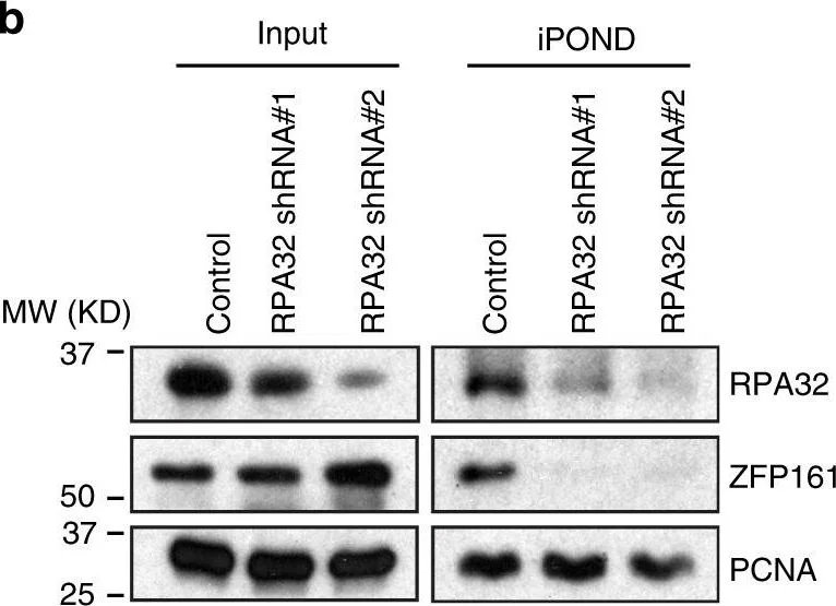 Western blot - Anti-RPA32/RPA2 (phospho T21) antibody [EPR2846(2)] (AB109394)