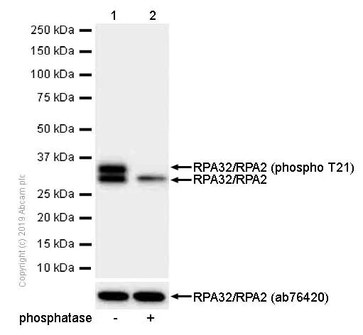 Western blot - Anti-RPA32/RPA2 (phospho T21) antibody [EPR2846(2)] (AB109394)