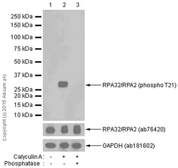 Western blot - Anti-RPA32/RPA2 (phospho T21) antibody [EPR2846(2)] - BSA and Azide free (AB240943)