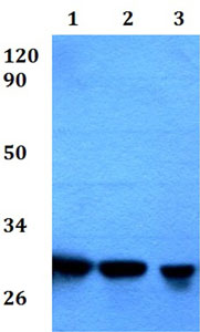 Western blot - Anti-RPA4 antibody - C-terminal (AB200742), expandable thumbnail