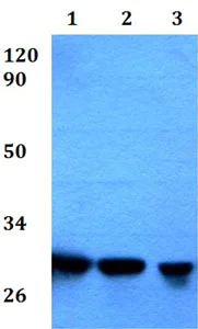 Western blot - Anti-RPA4 antibody - C-terminal (AB200742)