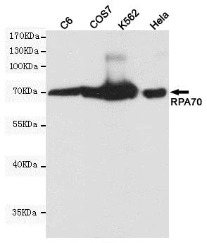 Western blot - Anti-RPA70 antibody [8C3-D12-H10] (AB176467)