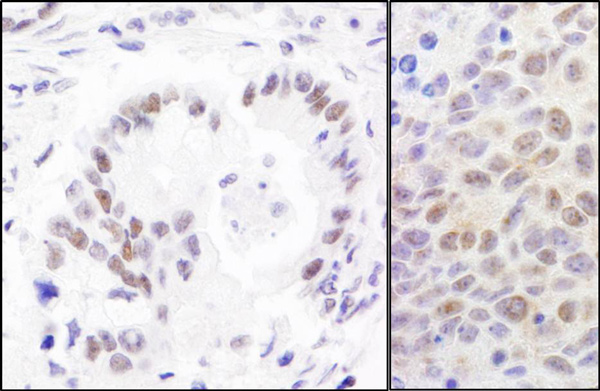Immunohistochemistry (Formalin/PFA-fixed paraffin-embedded sections) - Anti-RPA70 antibody (AB12320)