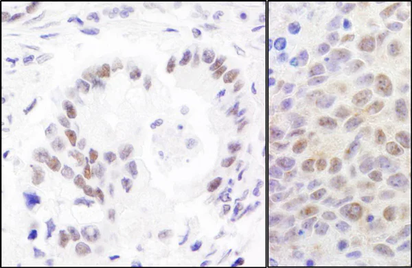 Immunohistochemistry (Formalin/PFA-fixed paraffin-embedded sections) - Anti-RPA70 antibody (AB12320)