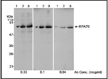 Western blot - Anti-RPA70 antibody (AB12320)