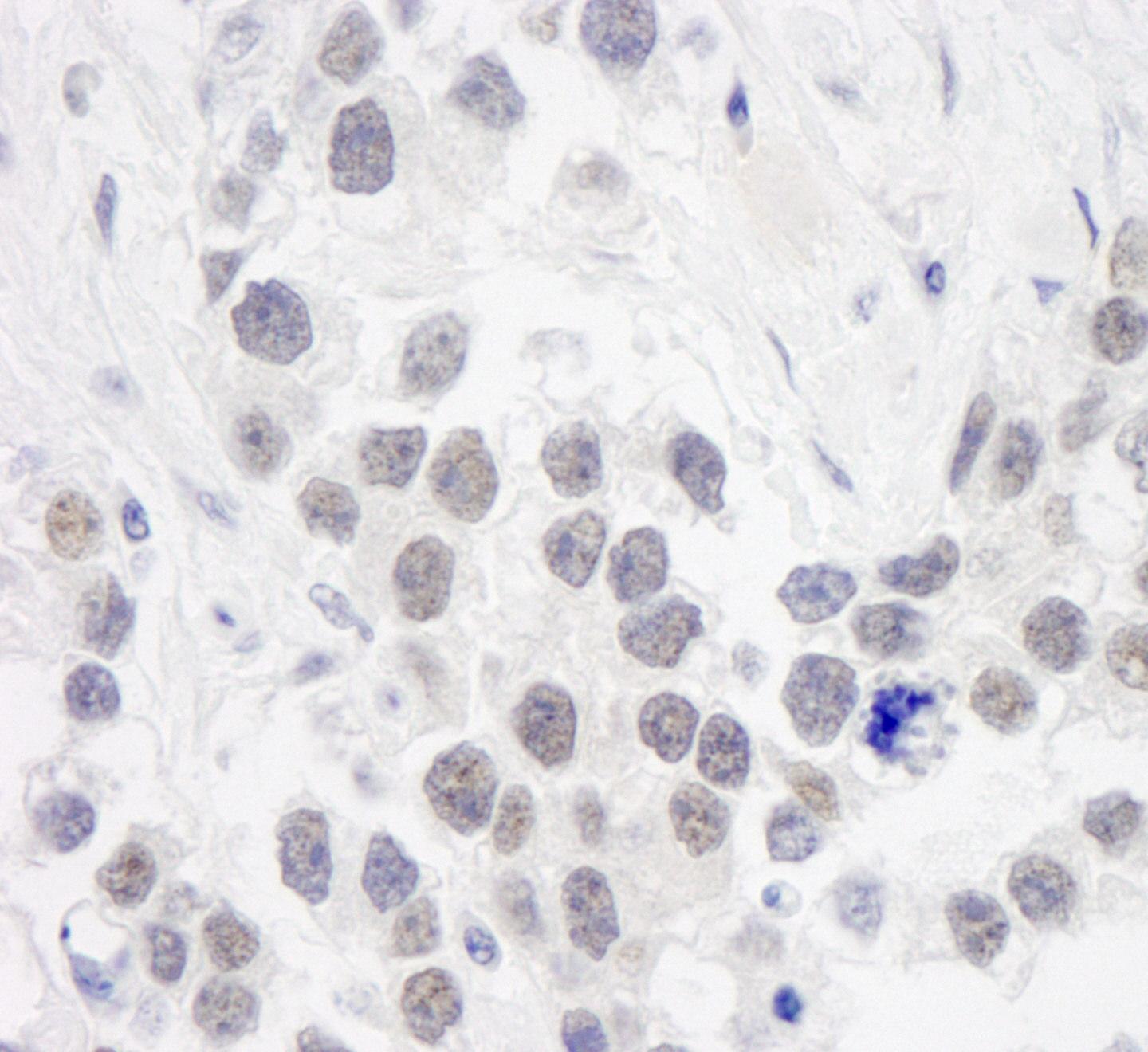 Immunohistochemistry (Formalin/PFA-fixed paraffin-embedded sections) - Anti-RPA70 antibody (AB87272)