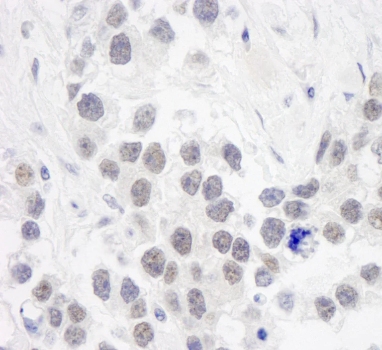Immunohistochemistry (Formalin/PFA-fixed paraffin-embedded sections) - Anti-RPA70 antibody (AB87272)