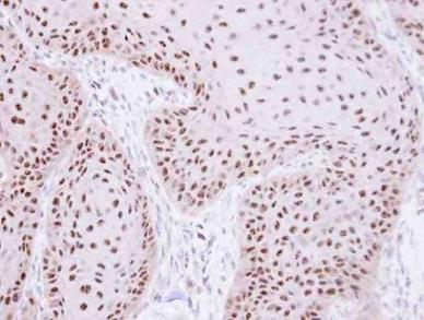 Immunohistochemistry (Formalin/PFA-fixed paraffin-embedded sections) - Anti-RPA70 antibody (AB97338)