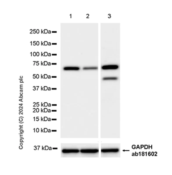 Western blot - Anti-RPA70 antibody [EPR27138-43] (AB317736)