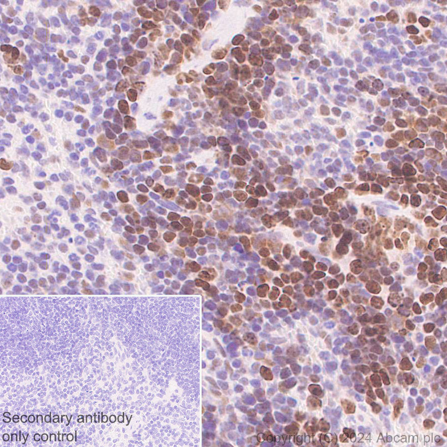 Immunohistochemistry (Formalin/PFA-fixed paraffin-embedded sections) - Anti-RPA70 antibody [EPR27138-43] - BSA and Azide free (AB317737), expandable thumbnail