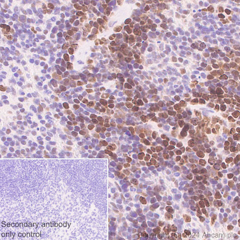 Immunohistochemistry (Formalin/PFA-fixed paraffin-embedded sections) - Anti-RPA70 antibody [EPR27138-43] - BSA and Azide free (AB317737)
