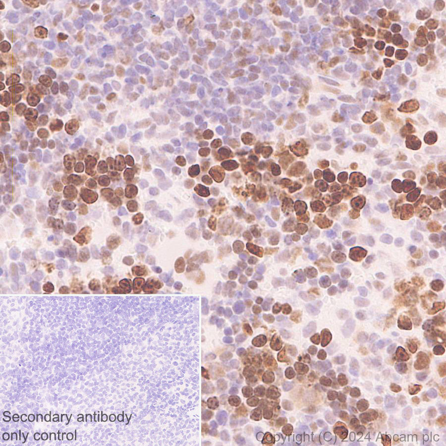 Immunohistochemistry (Formalin/PFA-fixed paraffin-embedded sections) - Anti-RPA70 antibody [EPR27138-43] - BSA and Azide free (AB317737), expandable thumbnail
