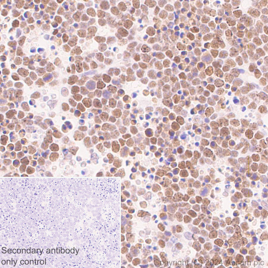 Immunohistochemistry (Formalin/PFA-fixed paraffin-embedded sections) - Anti-RPA70 antibody [EPR27138-43] - BSA and Azide free (AB317737), expandable thumbnail
