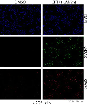 Immunocytochemistry/ Immunofluorescence - Anti-RPA70 antibody [EPR3472] (AB79398)