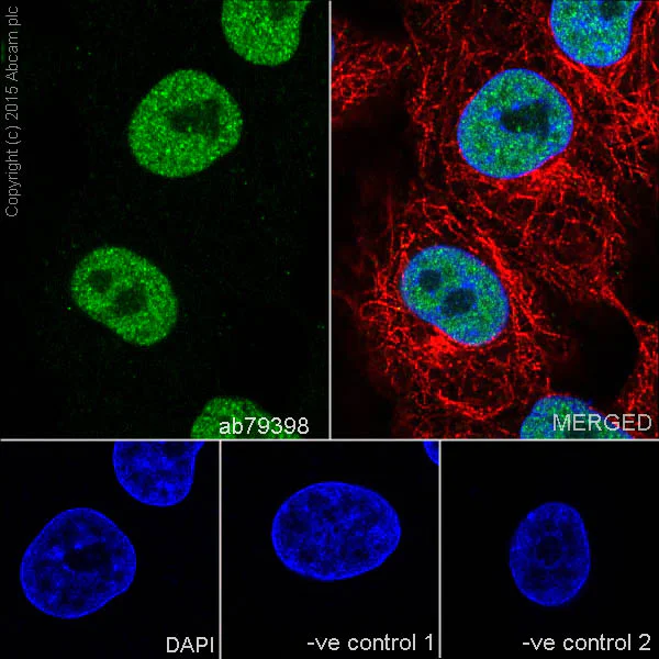 Immunocytochemistry/ Immunofluorescence - Anti-RPA70 antibody [EPR3472] (AB79398)