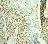 Immunohistochemistry (Formalin/PFA-fixed paraffin-embedded sections) - Anti-RPA70 antibody [EPR3472] (ab79398), expandable thumbnail