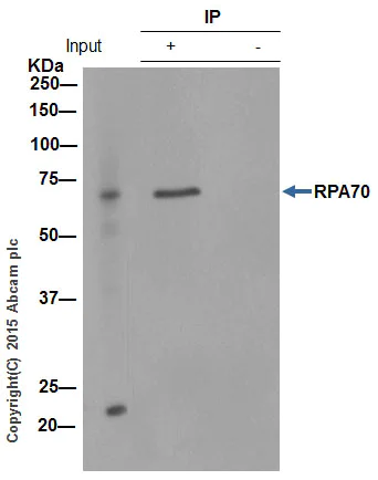 Immunoprecipitation - Anti-RPA70 antibody [EPR3472] (AB79398)