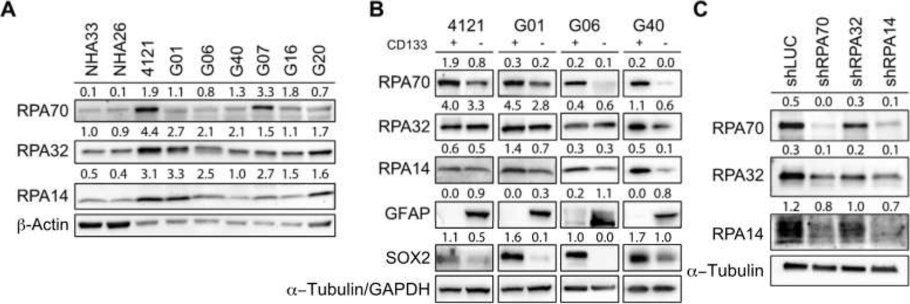 Western blot - Anti-RPA70 antibody [EPR3472] (ab79398), expandable thumbnail