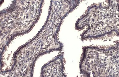 Immunohistochemistry (Formalin/PFA-fixed paraffin-embedded sections) - Anti-RPB2 antibody [HL1042] (AB307494)