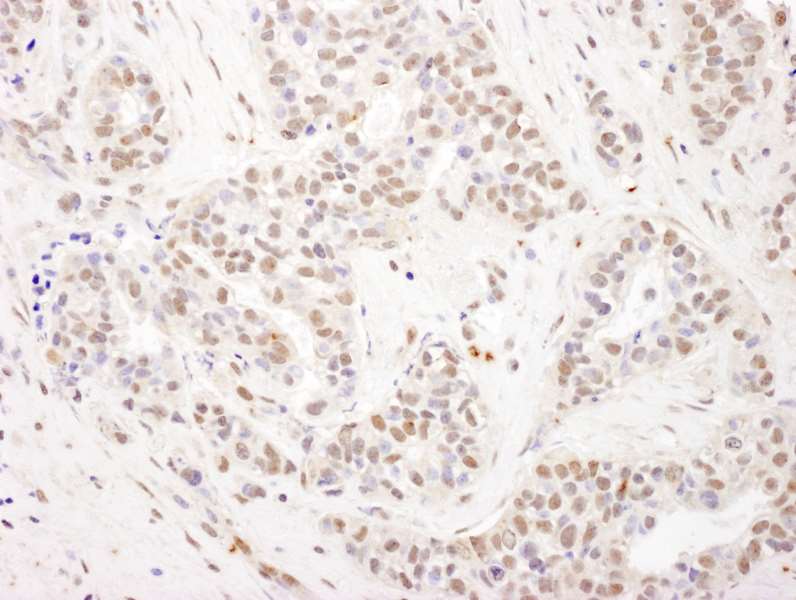 Immunohistochemistry (Formalin/PFA-fixed paraffin-embedded sections) - Anti-RPB3 antibody (AB138436)