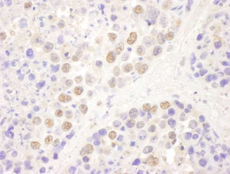 Immunohistochemistry (Formalin/PFA-fixed paraffin-embedded sections) - Anti-RPB3 antibody (AB138436)