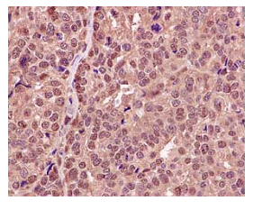 Immunohistochemistry (Formalin/PFA-fixed paraffin-embedded sections) - Anti-RPB3 antibody [EPR13294(B)] (AB182150)