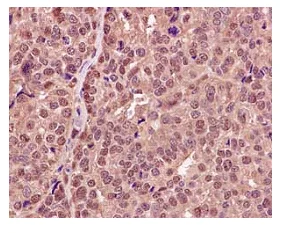 Immunohistochemistry (Formalin/PFA-fixed paraffin-embedded sections) - Anti-RPB3 antibody [EPR13294(B)] (AB182150)
