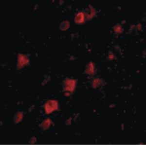 Immunocytochemistry/ Immunofluorescence - Anti-RPC39 antibody (AB76951), expandable thumbnail