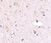 Immunohistochemistry (Formalin/PFA-fixed paraffin-embedded sections) - Anti-RPC39 antibody (AB76951), expandable thumbnail