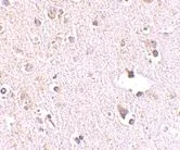 Immunohistochemistry (Formalin/PFA-fixed paraffin-embedded sections) - Anti-RPC39 antibody (AB76951)