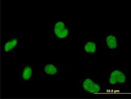 Immunocytochemistry/ Immunofluorescence - Anti-RPC62 antibody (AB88243)