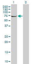 Western blot - Anti-RPC62 antibody (AB88243)