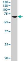 Western blot - Anti-RPC62 antibody (AB88243)